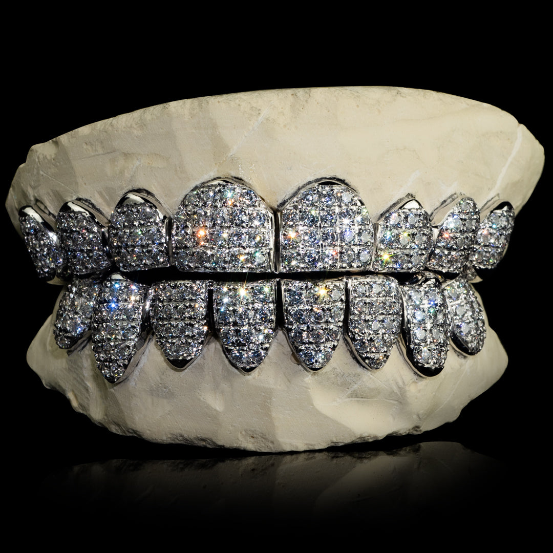 A relevant stock photo of moissanite grillz in a typical setting.