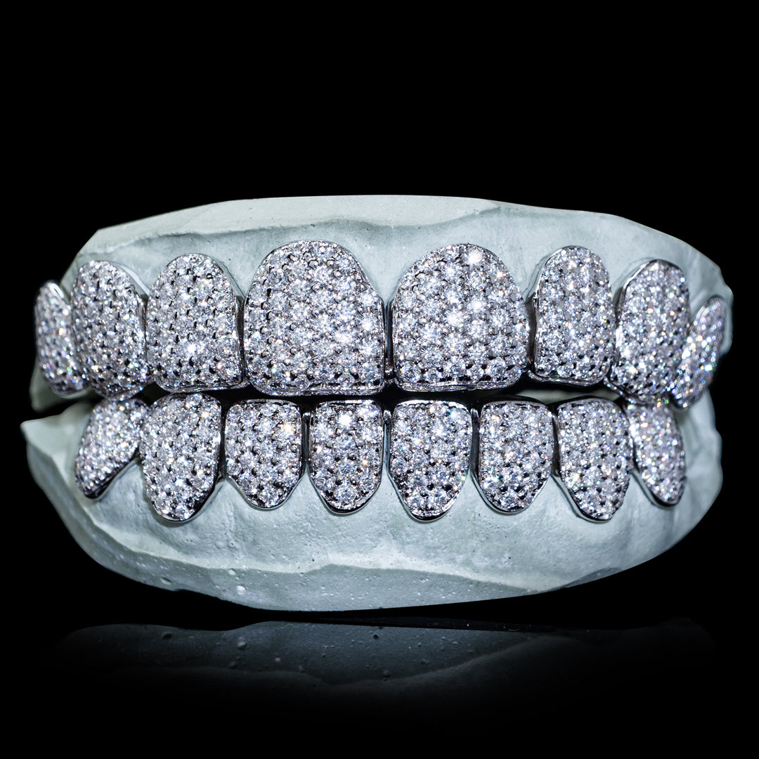 A relevant stock photo of moissanite grillz in a typical setting.
