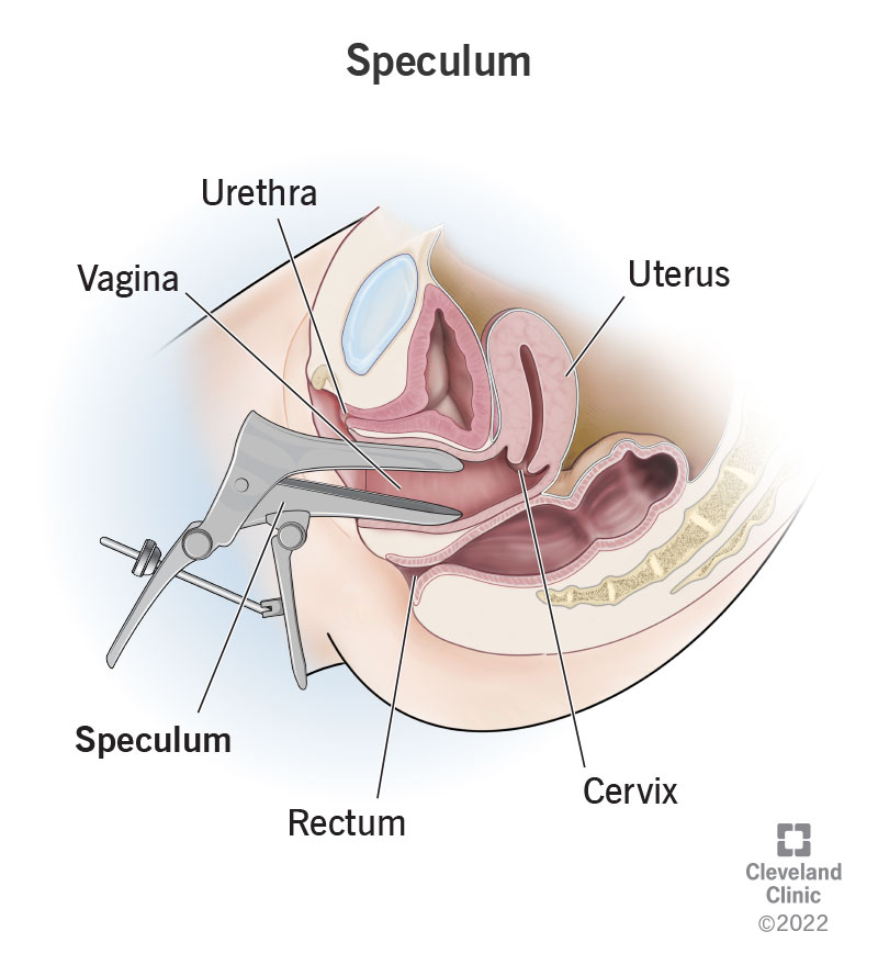 A relevant stock photo of speculum specula in a typical setting.